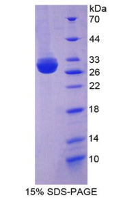 Figure 1. SDS-PAGE
