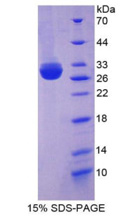 Figure 1. SDS-PAGE