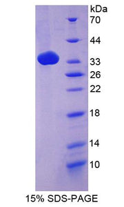 Figure 1. SDS-PAGE