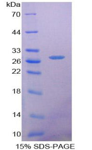 Figure 1. SDS-PAGE