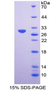 Figure 1. SDS-PAGE