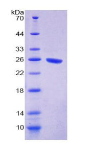 Figure 1. SDS-PAGE