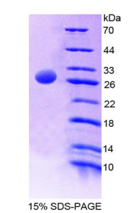 Figure 1. SDS-PAGE