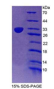 Figure 1. SDS-PAGE