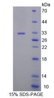 Figure 1. SDS-PAGE