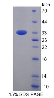 Figure 1. SDS-PAGE