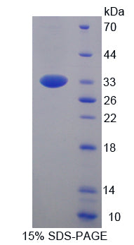 Figure 1. SDS-PAGE