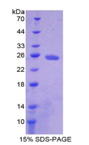 Figure 1. SDS-PAGE