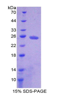 Figure 1. SDS-PAGE