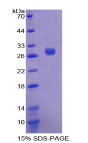 Figure 1. SDS-PAGE