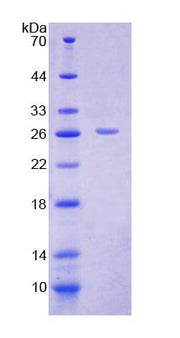 Figure 1. SDS-PAGE
