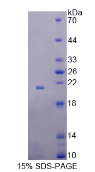 Figure 1. SDS-PAGE