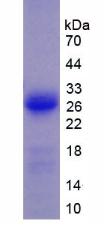Figure 2. SDS-PAGE