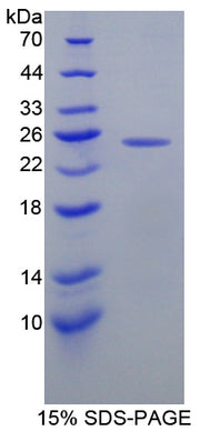 Figure 1. SDS-PAGE