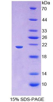 Figure 1. SDS-PAGE
