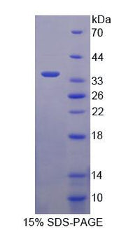Figure 1. SDS-PAGE