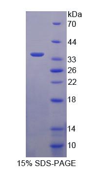 Figure 1. SDS-PAGE