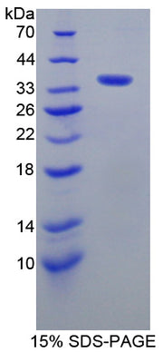 Figure 1. SDS-PAGE