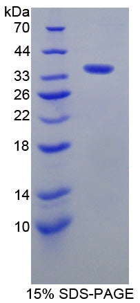Figure 1. SDS-PAGE