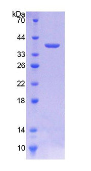 Figure 1. SDS-PAGE