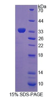 Figure 1. SDS-PAGE