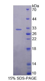 Figure 1. SDS-PAGE