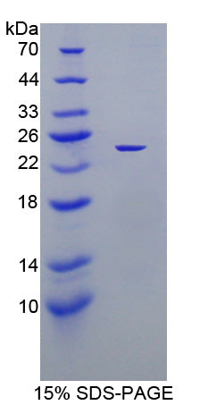 Figure 1. SDS-PAGE