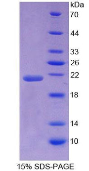 Figure 1. SDS-PAGE