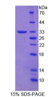 Figure 1. SDS-PAGE