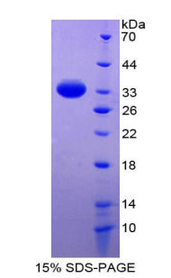 Figure 1. SDS-PAGE