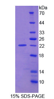 Figure 1. SDS-PAGE