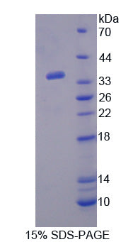 Figure 1. SDS-PAGE