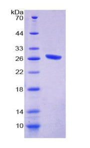 Figure 1. SDS-PAGE