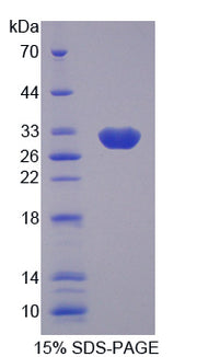 Figure 1. SDS-PAGE