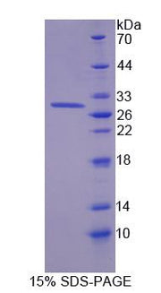 Figure 1. SDS-PAGE