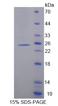 Figure 1. SDS-PAGE