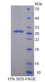 Figure 1. SDS-PAGE