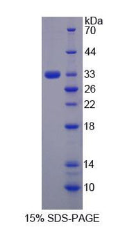Figure 1. SDS-PAGE