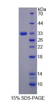 Figure 1. SDS-PAGE
