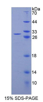 Figure 1. SDS-PAGE