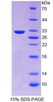 Figure 1. SDS-PAGE