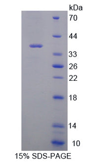 Figure 1. SDS-PAGE