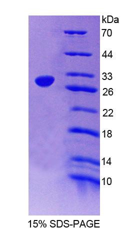 Figure 1. SDS-PAGE