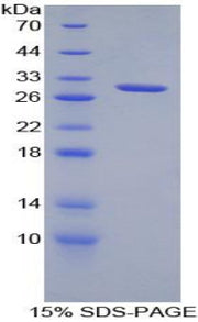 Figure 1. SDS-PAGE