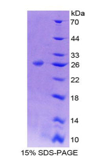Figure 1. SDS-PAGE