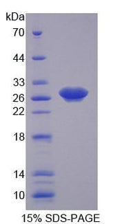 Figure 1. SDS-PAGE