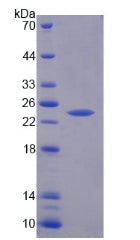 Figure 2. SDS-PAGE