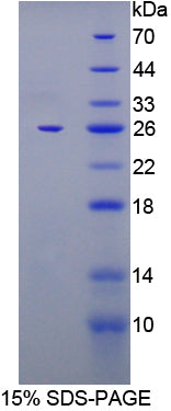 Figure 1. SDS-PAGE
