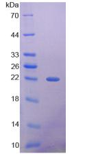 Figure 2. SDS-PAGE