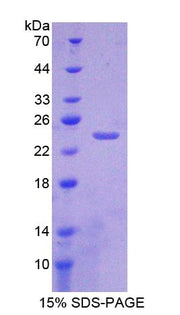 Figure 1. SDS-PAGE